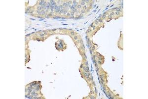 Immunohistochemistry of paraffin-embedded human prostate using GPI antibody.