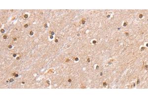 Immunohistochemistry (Paraffin-embedded Sections) (IHC (p)) image for anti-SWI/SNF Related, Matrix Associated, Actin Dependent Regulator of Chromatin, Subfamily B, Member 1 (SMARCB1) antibody (ABIN7237704)
