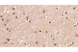 Immunohistochemistry of paraffin-embedded Human brain using SMARCB1 Polyclonal Antibody at dilution of 1:30 (SMARCB1 抗体)