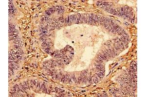 Immunohistochemistry (IHC) image for anti-Tumor Protein P53 (TP53) (AA 2-393) antibody (ABIN7147346)