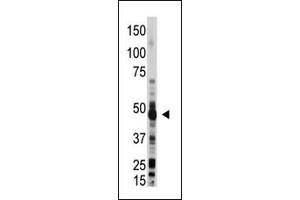 The anti-OAS1 Pab (ABIN390164 and ABIN2840661) is used in Western blot to detect OAS1 in mouse liver lysate. (OAS1 抗体  (C-Term))