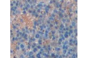 IHC-P analysis of Human Tissue, with DAB staining. (QPCT 抗体  (AA 29-361))
