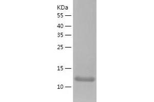 Western Blotting (WB) image for Dysbindin (Dystrobrevin Binding Protein 1) Domain Containing 1 (DBNDD1) (AA 1-158) protein (His tag) (ABIN7122726) (DBNDD1 Protein (AA 1-158) (His tag))