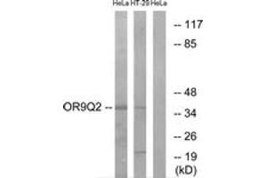 Western Blotting (WB) image for anti-Olfactory Receptor, Family 9, Subfamily Q, Member 2 (OR9Q2) (AA 232-281) antibody (ABIN2891065) (OR9Q2 抗体  (AA 232-281))
