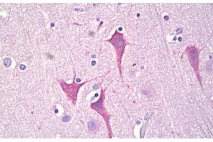 Anti-PKC Mu antibody IHC staining of human brain, cortex neurons. (PKC mu 抗体  (AA 171-220))