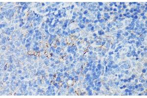 Immunohistochemistry of paraffin-embedded Rat spleen using CR2 Polyclonal Antibody at dilution of 1:100 (40x lens). (CD21 抗体)