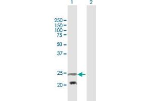 Western Blot analysis of PEMT expression in transfected 293T cell line by PEMT MaxPab polyclonal antibody.