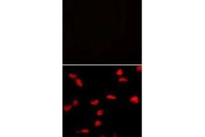 Immunofluorescence (IF) image for anti-SET Domain Containing (Lysine Methyltransferase) 8 (SETD8) (N-Term) antibody (ABIN3032551)
