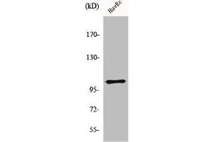 Western Blot analysis of HuvEc cells using mGluR-7 Polyclonal Antibody (GRM7 抗体  (C-Term))