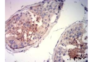 Immunohistochemical analysis of paraffin-embedded testi tissue using SP10 mouse mAb with DAB staining. (ACRV1 抗体  (AA 22-265))