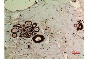 Immunohistochemistry (IHC) analysis of paraffin-embedded Human Breast, antibody was diluted at 1:100. (Ubiquitin 抗体  (acLys27))