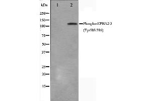 Western blot analysis on HepG2 cell lysate using Phospho-EPHA2/3(Tyr588/596) Antibody,The lane on the left is treated with the antigen-specific peptide. (EPHA2/3/4 抗体  (pTyr588, pTyr596))