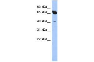 WB Suggested Anti-SCFD1 Antibody Titration: 0. (SCFD1 抗体  (N-Term))