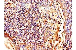 Immunohistochemistry of paraffin-embedded human tonsil tissue using ABIN7158656 at dilution of 1:100 (LEF1 抗体  (AA 75-216))