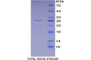 SDS-PAGE analysis of Mouse GSTa4 Protein. (GSTA4 蛋白)