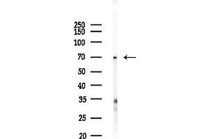 Western blot analysis of lysates from Hela cells(LPS 4h treatment), using Collagen XIII alpha 1 Antibody at 1/1000 dilution.