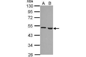 WB Image Sample (30 ug of whole cell lysate) A: A549 B: HCT116 10% SDS PAGE antibody diluted at 1:1000 (Ferredoxin Reductase 抗体)