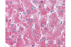 Immunohistochemistry (IHC) image for anti-serpin Peptidase Inhibitor, Clade A (Alpha-1 Antiproteinase, Antitrypsin), Member 1 (SERPINA1) antibody (ABIN290682)