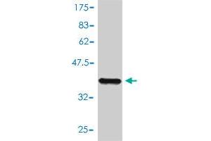 Western Blot detection against Immunogen (40. (NUMB 抗体  (AA 1-135))