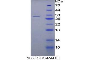 SDS-PAGE (SDS) image for Nucleoporin 88kDa (NUP88) (AA 57-296) protein (His tag) (ABIN1878915)