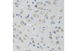 Immunohistochemistry of paraffin-embedded rat brain using HTR3A antibody (ABIN1876848) at dilution of 1:100 (40x lens). (Serotonin Receptor 3A 抗体)