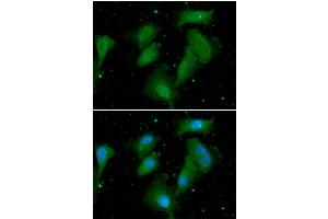 ICC/IF analysis of AKT1/3 in A549 cells. (AKT1/3 抗体)