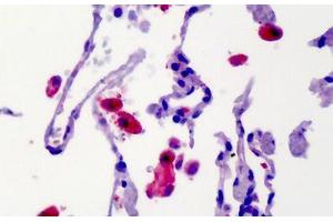 Human Lung: Formalin-Fixed, Paraffin-Embedded (FFPE) (CAMK2B 抗体)