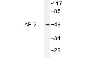 Image no. 1 for anti-Transcription Factor AP-2 alpha (Activating Enhancer Binding Protein 2 Alpha) (TFAP2A) antibody (ABIN265311)