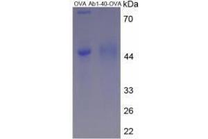 Image no. 3 for Amyloid beta 1-40 (Abeta 1-40) peptide (Ovalbumin) (ABIN5666070) (Amyloid beta 1-40 (Abeta 1-40) peptide (Ovalbumin))