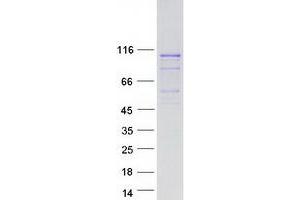 Western Blotting (WB) image for Leucine Rich Repeat Containing 41 (LRRC41) protein (Myc-DYKDDDDK Tag) (ABIN2724917)