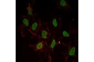 Immunofluorescence analysis of Hela cells using ESR1 mouse mAb (green). (Estrogen Receptor alpha 抗体)