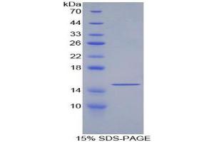 SDS-PAGE analysis of Human GDF6 Protein. (GDF6 蛋白)