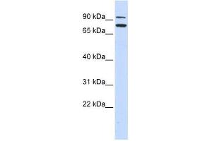 ZNF440 antibody used at 0. (ZNF440 抗体  (Middle Region))
