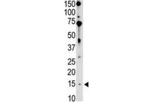 Western Blotting (WB) image for anti-BCL2-Interacting Killer (Apoptosis-Inducing) (BIK) (BH3 Domain) antibody (ABIN2997206) (BIK 抗体  (BH3 Domain))