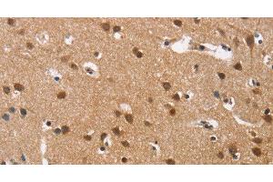 Immunohistochemistry of paraffin-embedded Human brain tissue using Cav1.