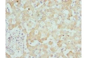 Immunohistochemistry of paraffin-embedded human liver tissue using ABIN7157806 at dilution of 1:100 (DCXR 抗体  (AA 1-244))