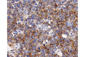 Immunohistochemistry analysis of paraffin-embedded human tonsil using CD192 Polyclonal Antibody at dilution of 1:300. (CCR2 抗体)