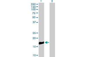 Western Blot analysis of ROBO3 expression in transfected 293T cell line by ROBO3 MaxPab polyclonal antibody. (ROBO3 抗体  (AA 1-147))