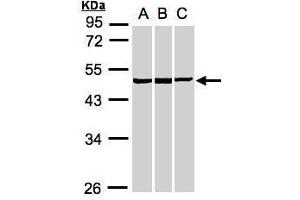WB Image Sample(30 ug whole cell lysate) A:A431, B:HeLa S3, C:MOLT4 , 10% SDS PAGE antibody diluted at 1:1000 (BZW2 抗体)