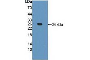 Detection of Recombinant APOB, Human using Polyclonal Antibody to Apolipoprotein B (APOB) (APOB 抗体  (AA 3365-3548))