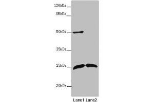 Western blot All lanes: ARHGDIG antibody at 2 μg/mL Lane 1: Mouse brain tissue Lane 2: Mouse lung tissue Secondary Goat polyclonal to rabbit IgG at 1/10000 dilution Predicted band size: 25 kDa Observed band size: 25, 50 kDa (ARHGDIG 抗体  (AA 1-225))