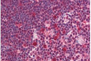 Human Thymus (formalin-fixed, paraffin-embedded) stained with SNW1 antibody ABIN214517 at 5 ug/ml followed by biotinylated goat anti-rabbit IgG secondary antibody ABIN481713, alkaline phosphatase-streptavidin and chromogen. (SNW1 抗体  (C-Term))