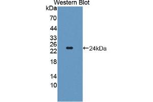Detection of Recombinant TWSG1, Human using Polyclonal Antibody to Twisted Gastrulation Protein Homolog 1 (TWSG1) (TWSG1 抗体  (AA 26-223))