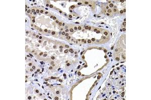 Immunohistochemistry of paraffin-embedded human kidney using H2AFY antibody at dilution of 1:100 (x400 lens). (H2AFY 抗体)