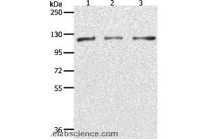 Western blot analysis of Hela, K562 and Jurkat cell, using PARP1 Polyclonal Antibody at dilution of 1:350 (PARP1 抗体)