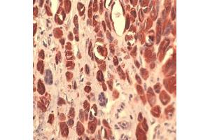 Image no. 1 for anti-S100 Calcium Binding Protein A4 (S100A4) (full length) antibody (ABIN5611426) (s100a4 抗体  (full length))