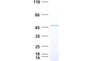 Validation with Western Blot