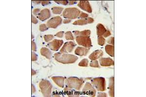 Formalin-fixed and paraffin-embedded human skeletal muscle reacted with RUVBL1 Antibody, which was peroxidase-conjugated to the secondary antibody, followed by DAB staining. (RUVBL1 抗体)