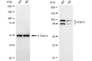 Western blotting analysis using FOXP1 antibody (ABIN7798652). (Recombinant FOXP1 抗体)