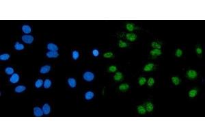 IF analysis of RNF20 using anti-RNF20 antibody (ABIN7599860). (RNF20 抗体  (AA 123-389))